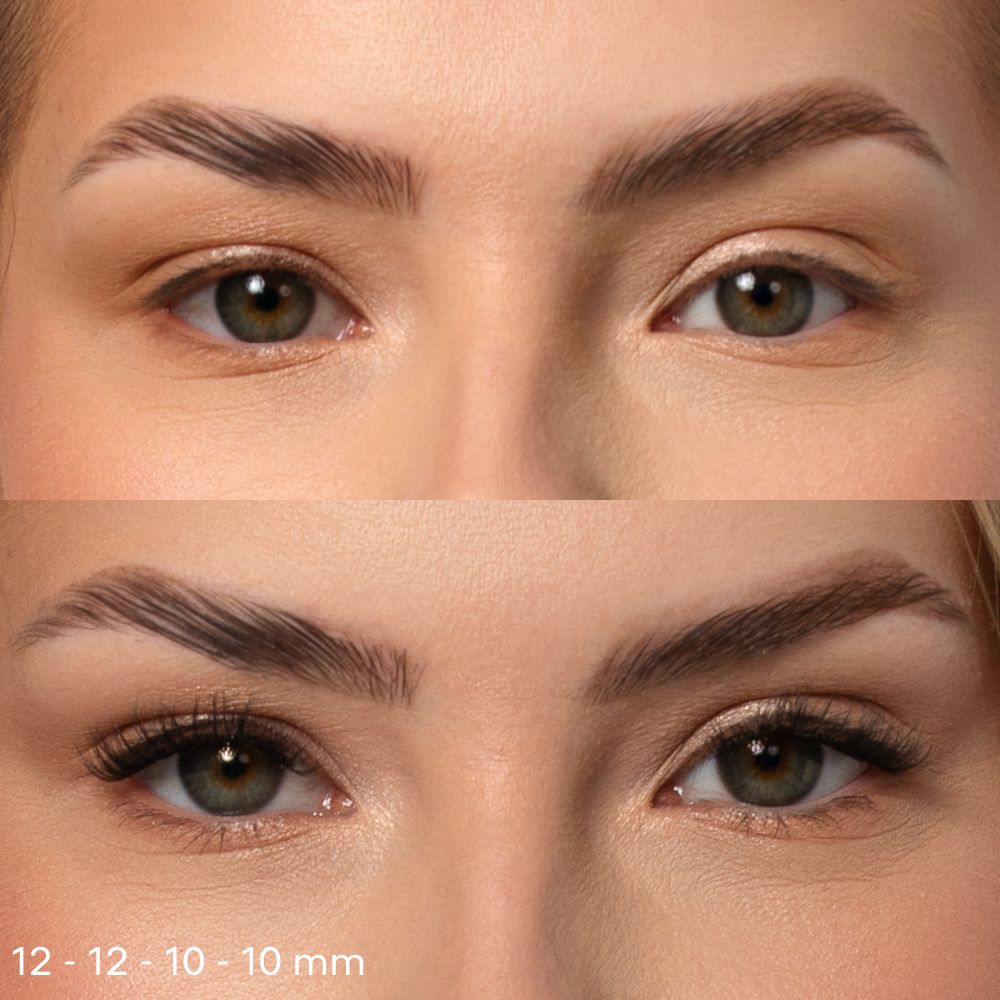 Jeden Tag vorher und nachher