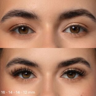 Volumenflaum vor und nach