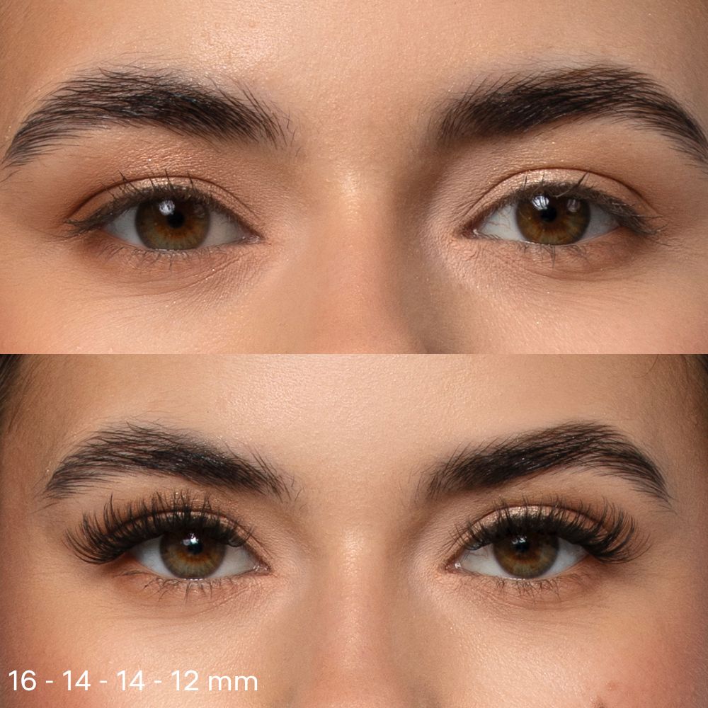 Volumenflaum vor und nach